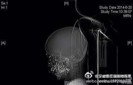 http://yisela.cn/uploadfile/2014/0821/20140821042153157.jpg