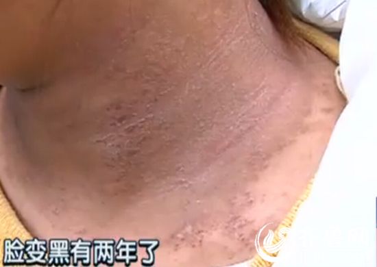 http://yisela.cn/uploadfile/2015/0420/20150420032342279.jpg