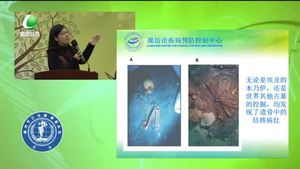 健康大講堂 攜手防控結核?。ㄉ希? />
													</a>
						<dl>
							<dt><a href=